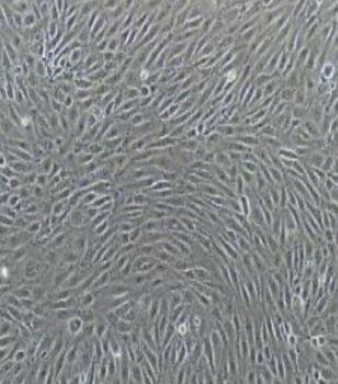 小鼠淋巴管内皮细胞,Mouse lymphatic endothelial cells
