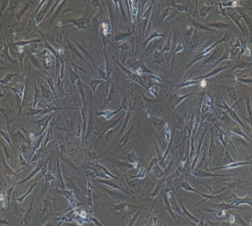 小鼠骨髓基质细胞,Mouse bone marrow stromal cells