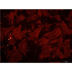 小鼠胰腺星状细胞,Mouse pancreatic stellate cells