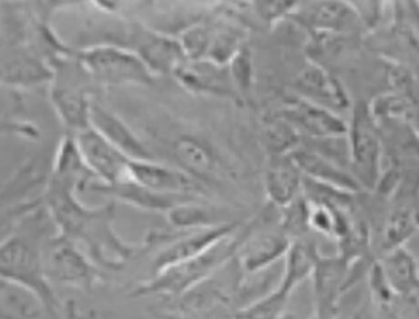 小鼠肝动脉平滑肌细胞,Mouse hepatic artery smooth muscle cells