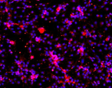 小鼠肝窦内皮细胞,Mouse sinusoidal endothelial cells