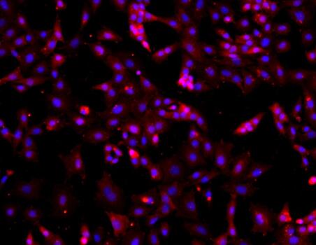 小鼠卵巢颗粒细胞,Granulosa cells of mouse ovary