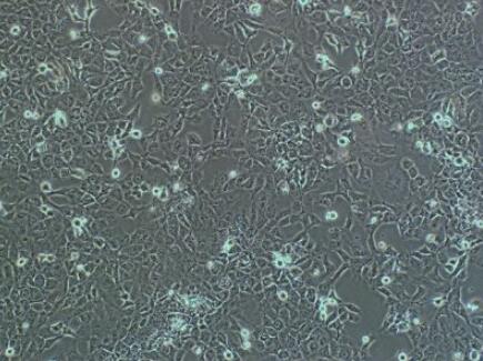 小鼠卵巢成纤维细胞,Mouse ovarian fibroblasts