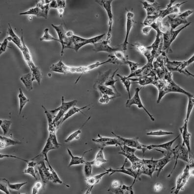 小鼠腎小球系膜細(xì)胞,Mouse glomerular mesangial cells