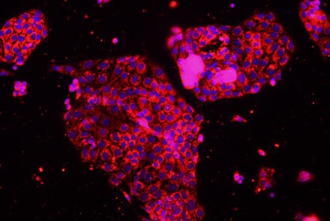 小鼠腎小管上皮細(xì)胞,Mouse Renal Tubular Epithelial Cells