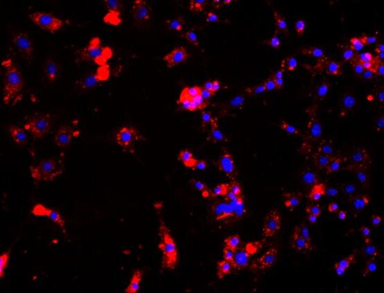 小鼠肾小球内皮细胞,Mouse glomerular endothelial cells