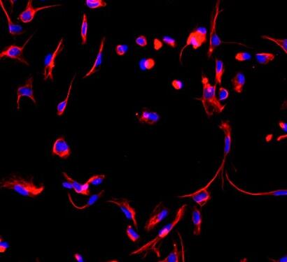 小鼠心肌成纤维细胞,Mouse cardiac fibroblasts