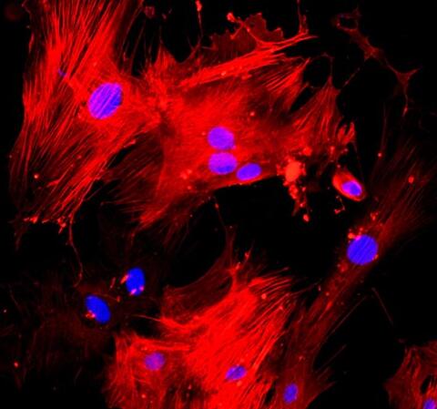 小鼠主动脉平滑肌细胞,Mouse aortic smooth muscle cells