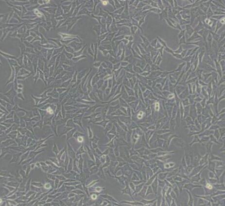 小鼠血管外膜成纤维细胞,Mouse adventitia fibroblasts