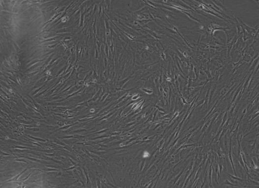 小鼠大隐静脉平滑肌细胞,Smooth muscle cells of great saphenous vein in mice