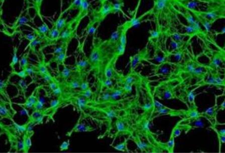 小鼠大隐静脉内皮细胞,Mouse saphenous vein endothelial cells