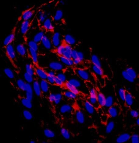 小鼠冠状动脉内皮细胞,Mouse coronary artery endothelial cells