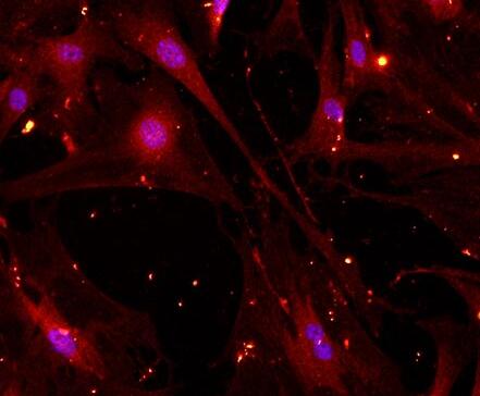 小鼠滑膜细胞,Mouse synovial cells