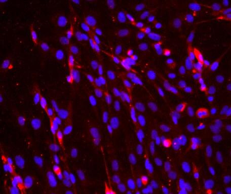 小鼠骨骼肌細(xì)胞,Mouse skeletal muscle cells