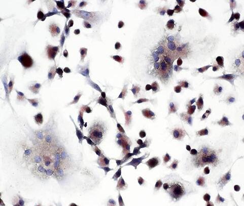 小鼠破骨细胞,Mouse osteoclast