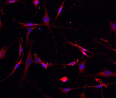 小鼠关节软骨细胞,Mouse articular chondrocytes