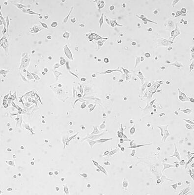 小鼠表皮黑色素细胞,Mouse epidermal melanocytes