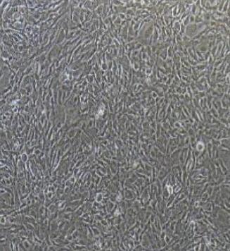 小鼠脑动脉血管内皮细胞,Mouse cerebral artery endothelial cells