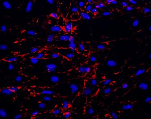 小鼠脑微血管内皮细胞,Mouse brain microvascular endothelial cells