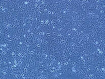 小鼠腦成纖維細(xì)胞,Mouse brain fibroblasts