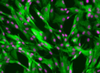 小鼠小脑颗粒细胞,Mouse cerebellar granule cells