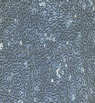 小鼠视网膜微血管内皮细胞,Mouse retinal microvascular endothelial cells