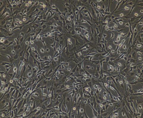 小鼠视网膜色素上皮细胞,Mouse retinal pigment epithelial cells