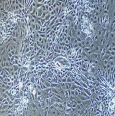 小鼠晶状体上皮细胞,Mouse lens epithelial cells