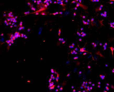 小鼠视网膜神经节细胞,Mouse retinal ganglion cells