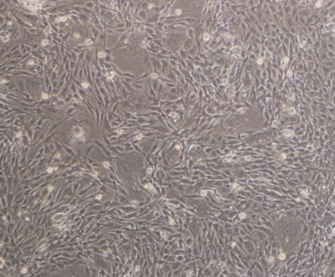 小鼠脉络膜血管内皮细胞,Mouse choroidal vascular endothelial cells