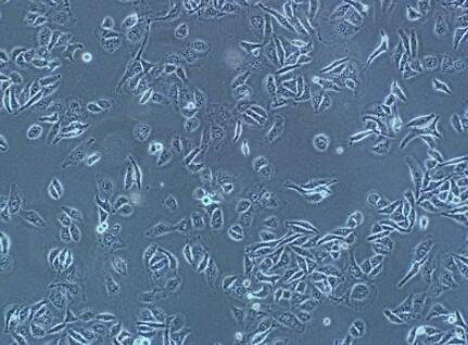 小鼠睾丸支持细胞,Sertoli cells of mouse testis