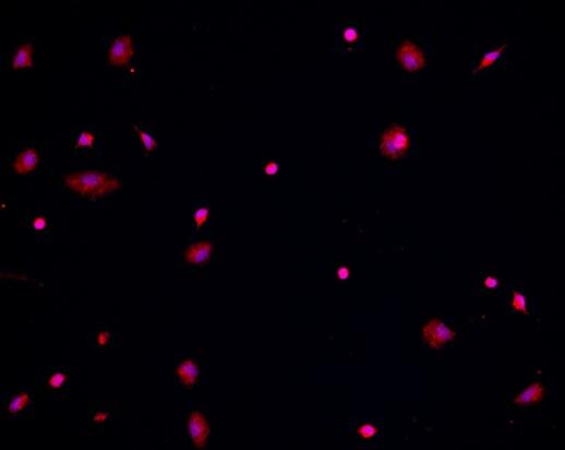 小鼠腹腔巨噬细胞,Mouse peritoneal macrophages