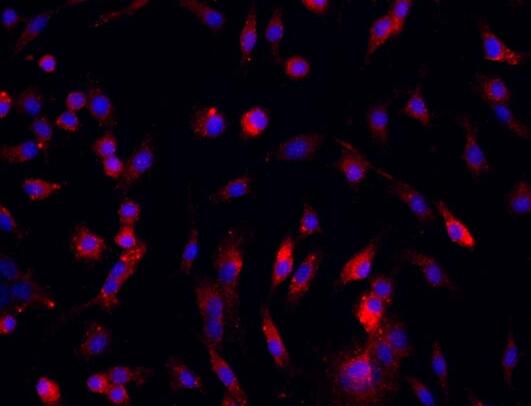 小鼠骨髓間充質(zhì)干細胞,Mouse bone marrow mesenchymal stem cells