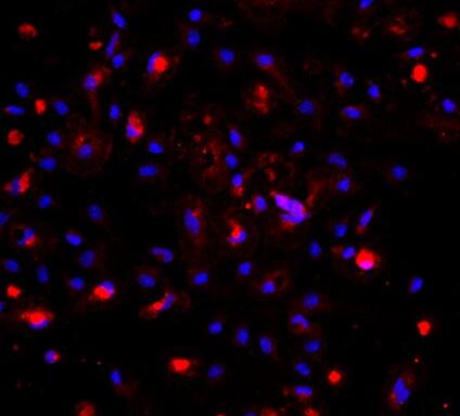小鼠肝枯否细胞,Kupffer cells of mouse liver