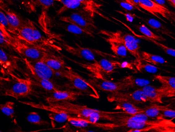 小鼠胚胎成纤维细胞,Mouse embryonic fibroblast