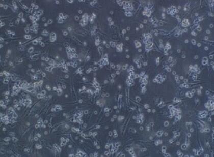 小鼠前列腺干细胞,Mouse prostate stem cells