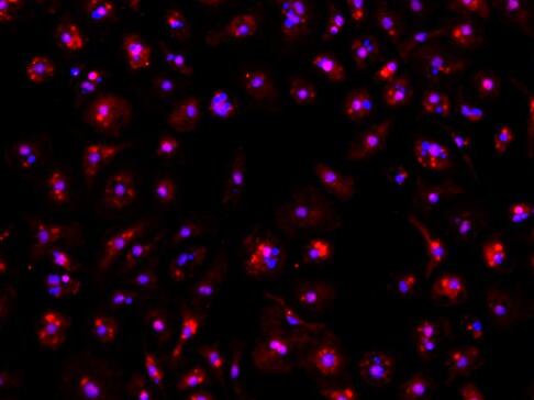 小鼠骨髓來(lái)源內(nèi)皮祖細(xì)胞,Mouse bone marrow derived endothelial progenitor cells