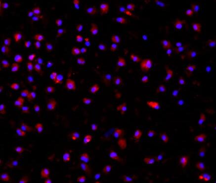 小鼠骨髓来源巨噬细胞,Mouse bone marrow derived macrophages