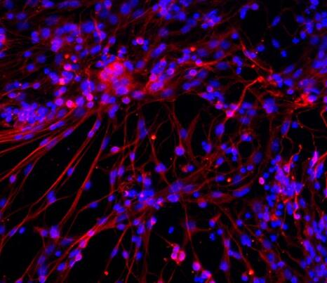 小鼠皮层神经元细胞,Mouse cortical neurons