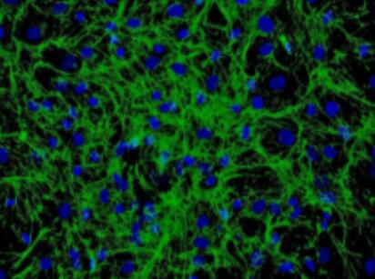 小鼠胎盤絨毛膜滋養(yǎng)層細(xì)胞,Mouse placental chorionic trophoblast cells