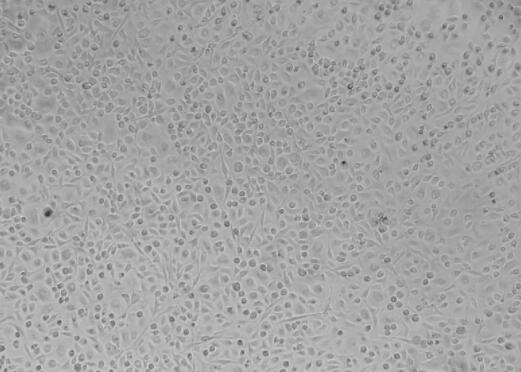 小鼠椎間盤髓核細(xì)胞,Mouse intervertebral disc nucleus pulposus cells