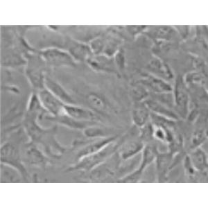小鼠肝动脉平滑肌细胞,Mouse hepatic artery smooth muscle cells