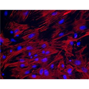 小鼠子宫平滑肌细胞,Mouse uterine smooth muscle cells