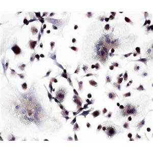 小鼠破骨细胞,Mouse osteoclast