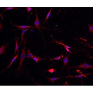 小鼠关节软骨细胞,Mouse articular chondrocytes