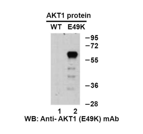 AKT1(E49K) 小鼠单抗,Anti-AKT1(E49K) Mouse Monoclonal Antibody