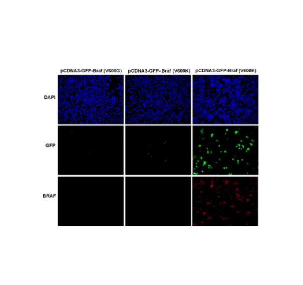 BRAF(V600M) 小鼠單抗,Anti-BRAF(V600M) Mouse Monoclonal Antibody