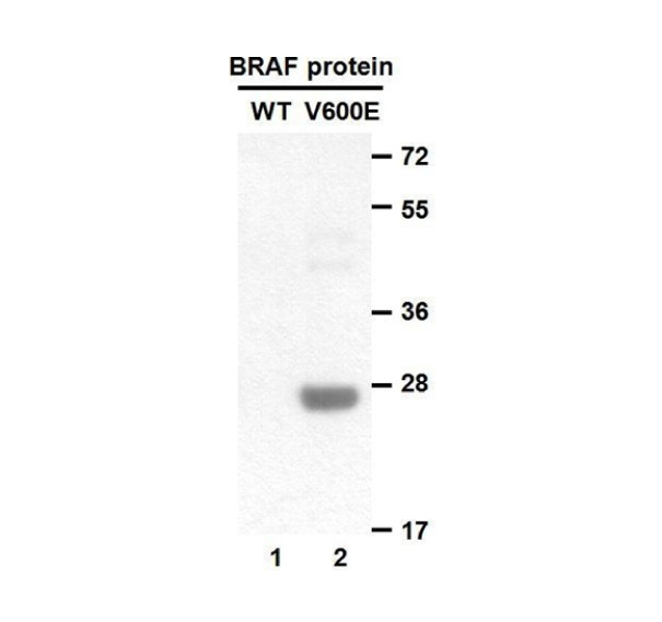 BRAF(V600E) 小鼠单抗,Anti-BRaf(V600E) Mouse Monoclonal Antibody