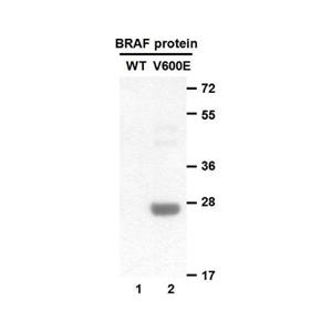 BRAF(V600E) 小鼠单抗,Anti-BRaf(V600E) Mouse Monoclonal Antibody