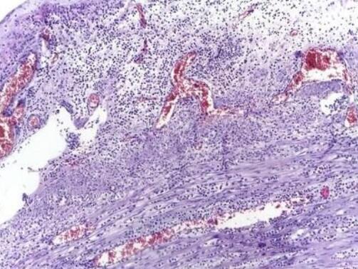 小鼠外周血中性粒细胞,Mouse peripheral blood neutrophils